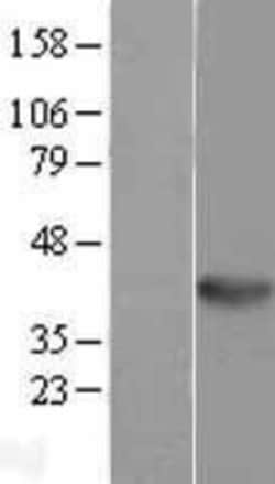 Novus Biologicals&trade;&nbsp;Wnt-5b Overexpression Lysate