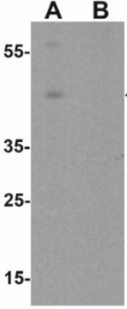 Wnt-5b Antibody - BSA Free, Novus Biologicals 0.025 mg, Unlabeled:Antibodies,