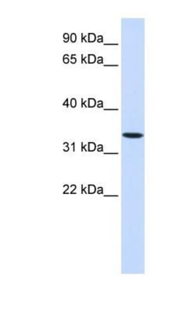 Wnt-6 Antibody, Novus Biologicals 100 &mu;L | Buy Online | Novus Biologicals | Fisher Scientific