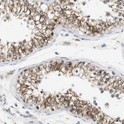 Wnt-7a Antibody, Novus Biologicals 0.1mL; Unlabeled:Antibodies, Polyclonal