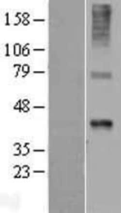 Novus Biologicals&trade;&nbsp;Wnt-7b Overexpression Lysate