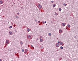 Wnt-7b Antibody, Novus Biologicals 0.05mg; Unlabeled:Antibodies, Polyclonal