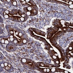 TMEM65 Antibody, Novus Biologicals:Antibodies:Primary Antibodies