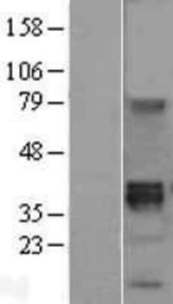 Novus Biologicals™ Wnt-8b Overexpression Lysate