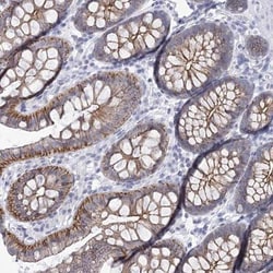 Wnt-8b Antibody, Novus Biologicals 25 &mu;L; Unlabeled:Antibodies, Polyclonal