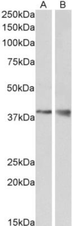 Wnt-9b Antibody, Novus Biologicals 0.1mg; Unlabeled:Antibodies, Polyclonal