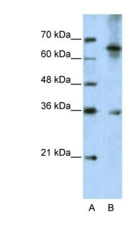 Wnt-9b Antibody, Novus Biologicals 100&mu;L; Unlabeled:Antibodies, Polyclonal