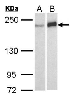 WRN Antibody, Novus Biologicals 0.1mL; Unlabeled:Antibodies, Polyclonal