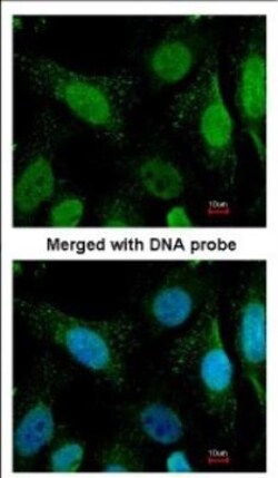 WRN Antibody, Novus Biologicals 0.1mL; Unlabeled:Antibodies, Polyclonal