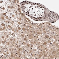 WRN Antibody, Novus Biologicals 0.1mL; Unlabeled:Antibodies, Polyclonal