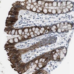 WSCD1 Antibody, Novus Biologicals 25 &mu;L; Unlabeled:Antibodies, Polyclonal