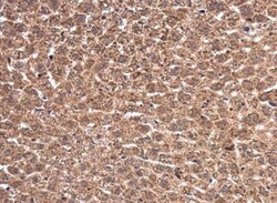 WT1 Antibody, Novus Biologicals 0.1mL; Unlabeled:Antibodies, Polyclonal