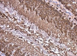 WT1 Antibody, Novus Biologicals 0.1mL; Unlabeled:Antibodies, Polyclonal