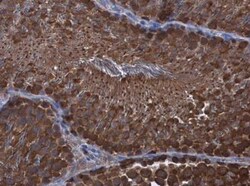 WT1 Antibody, Novus Biologicals 0.1mL; Unlabeled:Antibodies, Polyclonal