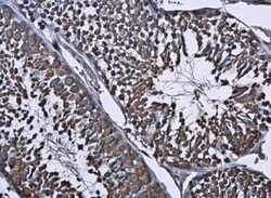 WT1 Antibody, Novus Biologicals 0.1mL; Unlabeled:Antibodies, Polyclonal