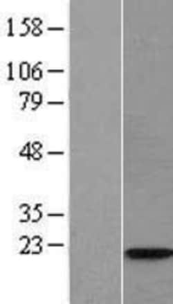 Novus Biologicals&trade;&nbsp;WTAP Overexpression Lysate