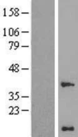 Novus Biologicals™ WW domain binding protein 5 Overexpression Lysate