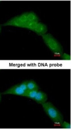 WWOX Antibody, Novus Biologicals 0.1mg; Unlabeled:Antibodies, Polyclonal