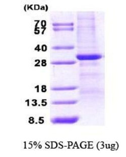 Novus Biologicals&trade;&nbsp;Recombinant Human WWOX His Protein