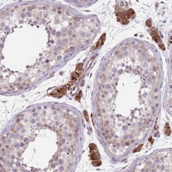 WWOX Antibody, Novus Biologicals 25 &mu;L; Unlabeled:Antibodies, Polyclonal