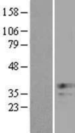 Novus Biologicals&trade;&nbsp;XAF1 Overexpression Lysate