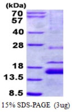 Novus Biologicals Recombinant Human XAGE1 His Protein 0.01 mg | Buy Online | Novus Biologicals&trade; | Fisher Scientific