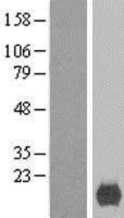 Novus Biologicals™ XAGE2 Overexpression Lysate