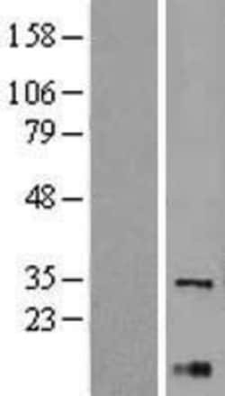 Novus Biologicals&trade;&nbsp;XBP1 Overexpression Lysate