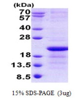 Novus Biologicals&trade;&nbsp;Recombinant Human Xg His Protein
