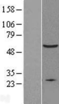 Novus Biologicals&trade;&nbsp;XIAP Overexpression Lysate