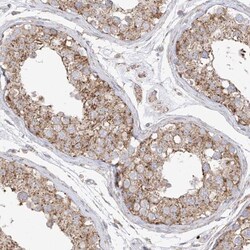 XKR3 Antibody, Novus Biologicals 25 &mu;L, Unlabeled:Antibodies, Polyclonal