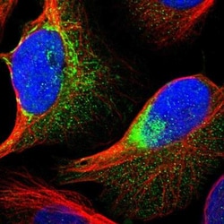 XK X-linked Kx blood group Antibody, Novus Biologicals:Antibodies:Primary