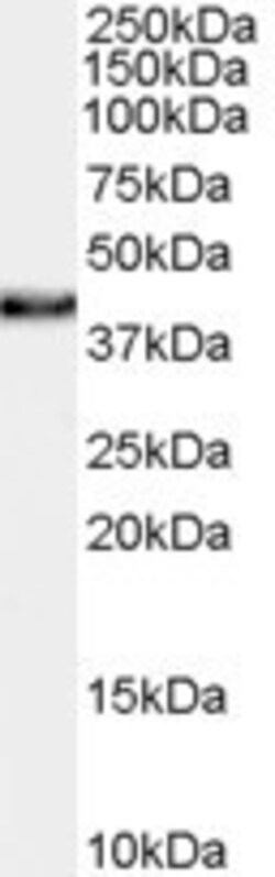 XLF Antibody, Novus Biologicals 0.1mg; Unlabeled:Antibodies, Polyclonal