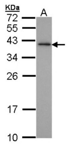 XLF Antibody, Novus Biologicals 0.1mg; Unlabeled:Antibodies, Polyclonal