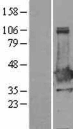 Novus Biologicals&trade;&nbsp;XLF Overexpression Lysate