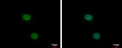 XLF Antibody, Novus Biologicals 0.1mg; Unlabeled:Antibodies, Polyclonal