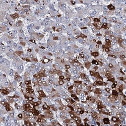XP32 Antibody, Novus Biologicals:Antibodies:Primary Antibodies