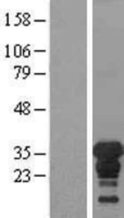 Novus Biologicals&trade;&nbsp;XPA Overexpression Lysate