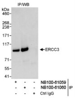 XPB Antibody, Novus Biologicals 0.1mg; Unlabeled:Antibodies, Polyclonal