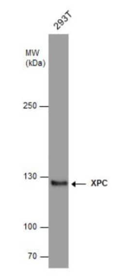 XPC Antibody (3.26), Novus Biologicals 0.1mg; Unlabeled:Antikörper