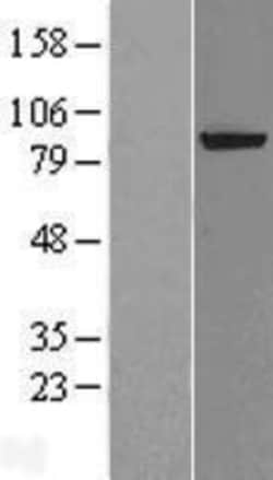 Novus Biologicals&trade;&nbsp;XPD Overexpression Lysate