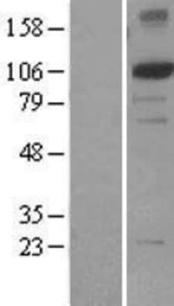 Novus Biologicals&trade;&nbsp;XPF Overexpression Lysate