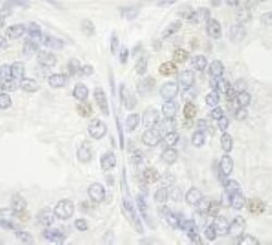 XPF Antibody, Novus Biologicals 0.1mL; Unlabeled:Antibodies, Polyclonal