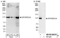 XPF Antibody, Novus Biologicals 0.1mL; Unlabeled:Antibodies, Polyclonal