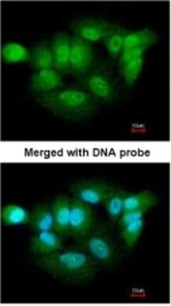 XPNPEP3 Antibody, Novus Biologicals 0.1mg; Unlabeled:Antibodies, Polyclonal