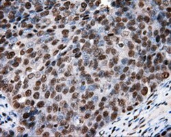 XRCC1 Antibody (OTI2F8), Novus Biologicals 0.1mL; Unlabeled:Antibodies,
