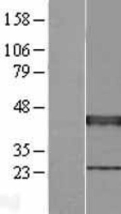 Novus Biologicals&trade;&nbsp;XRCC3 Overexpression Lysate
