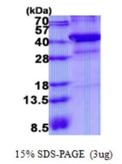 Novus Biologicals&trade;&nbsp;Recombinant Human XRCC3 His Protein