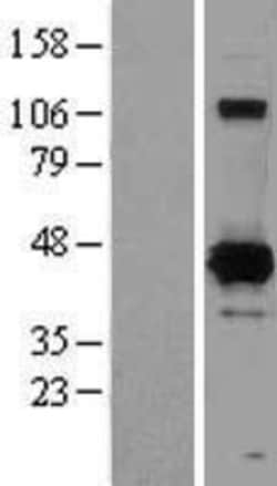 Novus Biologicals&trade;&nbsp;XRCC4 Overexpression Lysate