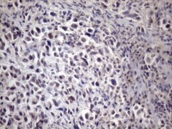 XRCC6BP1 Antibody (OTI5F3), Novus Biologicals 0.1mL; Unlabeled:Antibodies,